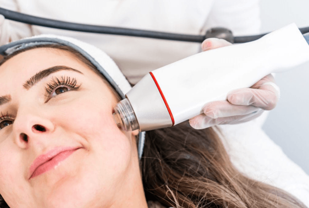RF Microneedling | JPP Skin Laser Clinic